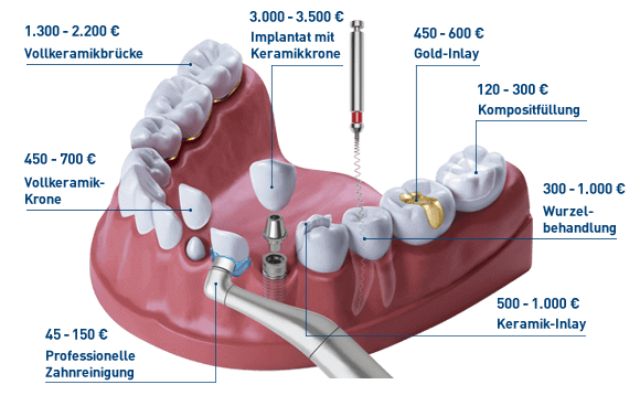 Zahnbehandlung beim Zahnarzt